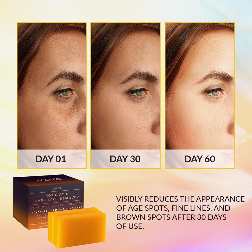 Kojic Acid Dark Spot Remover Soap